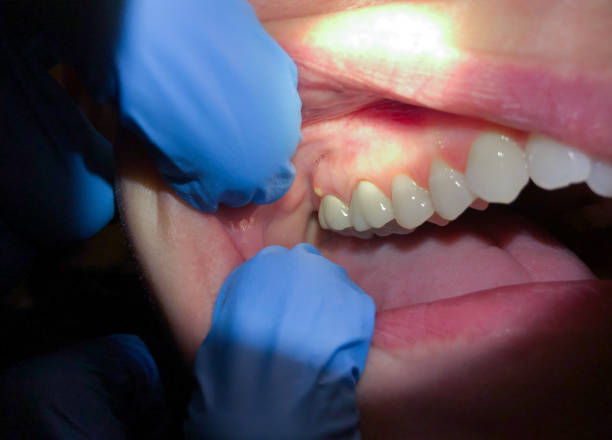 Best Emergency Gum Pain Relief  in New Brighton, MN